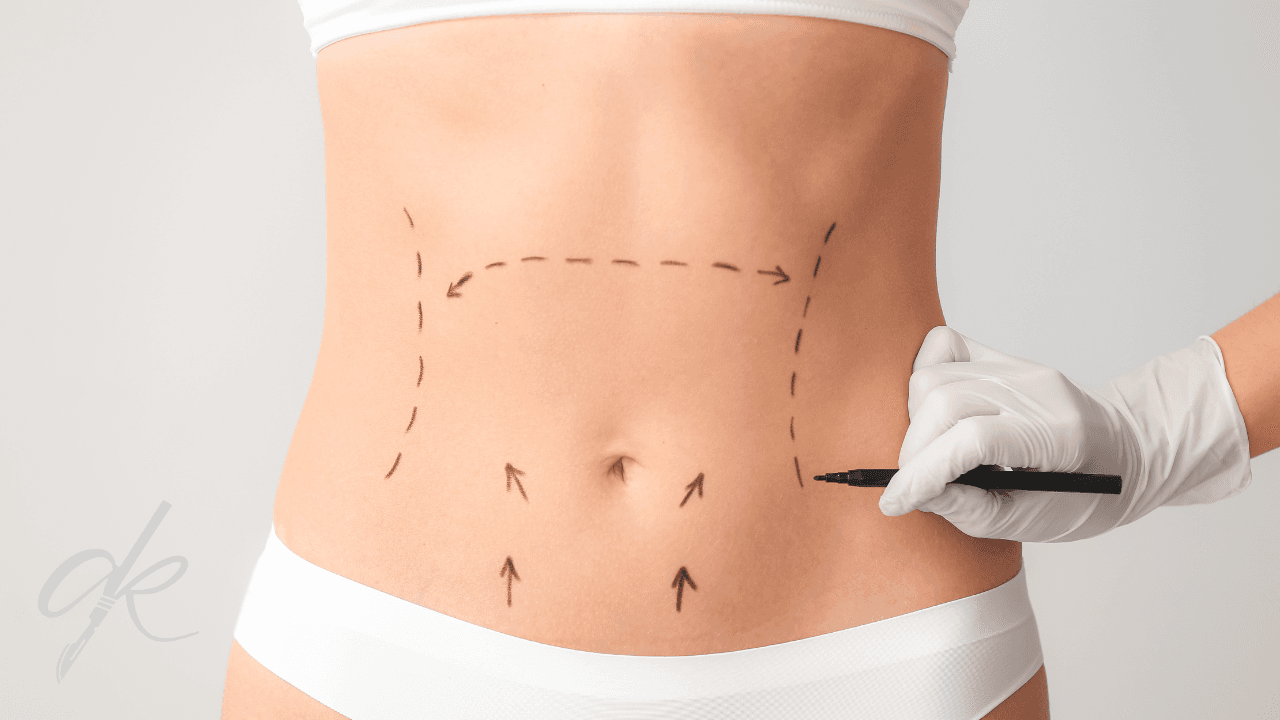 Wie lange dauert eine Abdominoplastik-Operation