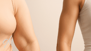 Oberarmstraffung oder Oberarmliposuktion?
