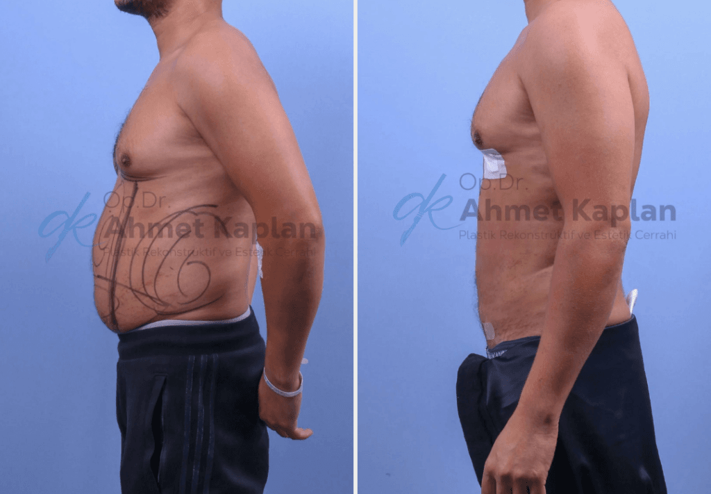 Male Aesthetics in Turkey