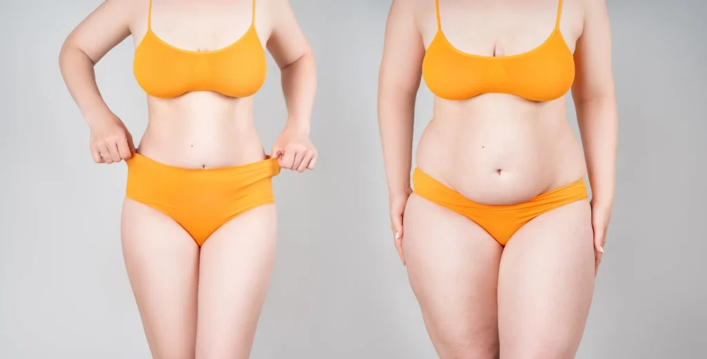 Intervento di Mommy Makeover