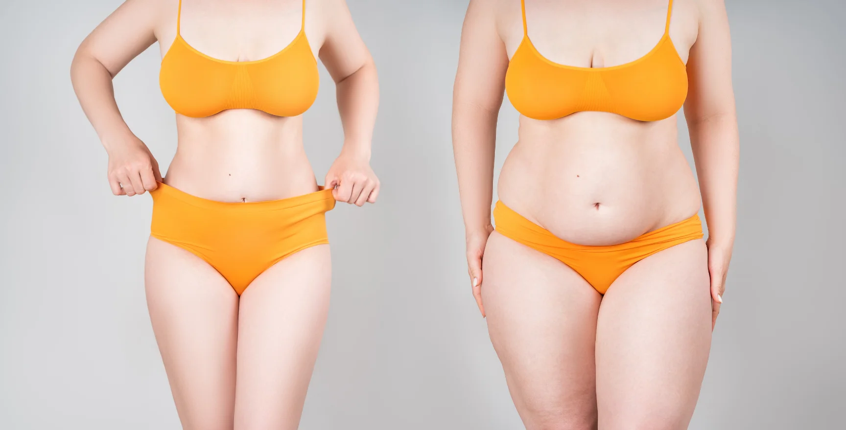 Intervento di Mommy Makeover