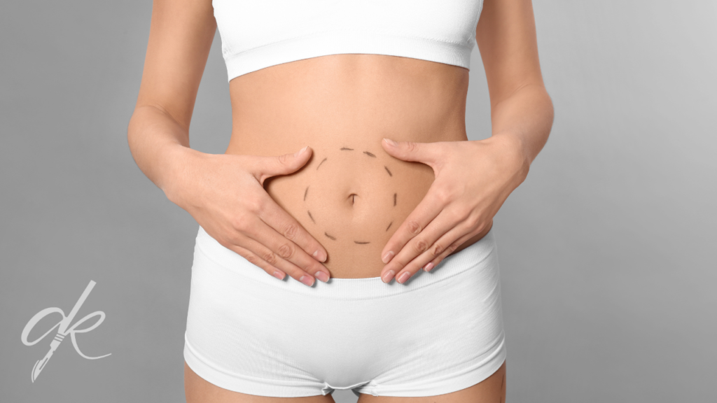 Che cos'è l'addominoplastica e come viene eseguita?