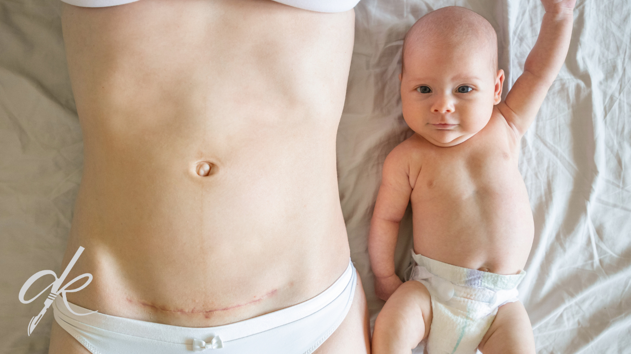 Prezzi dell'Estetica della Maternità nel 2025