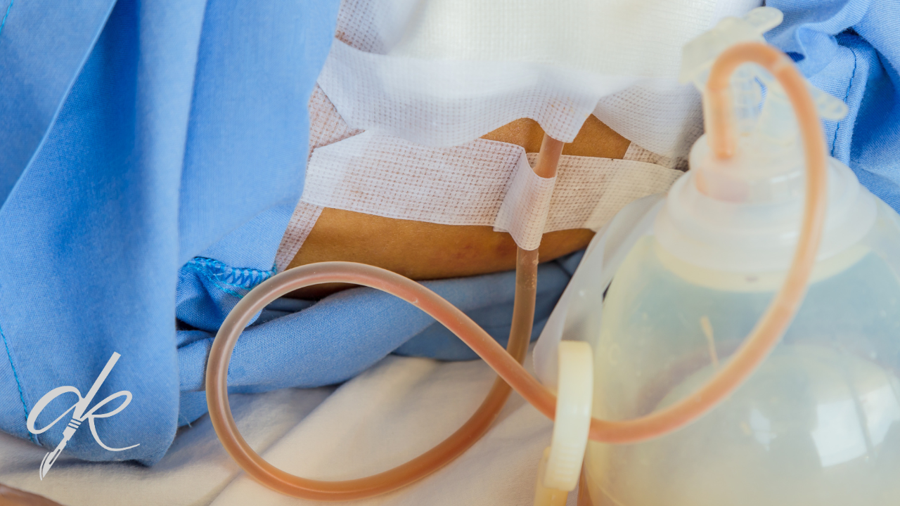 L'Uso dei Drenaggi negli Interventi di Chirurgia Plastica