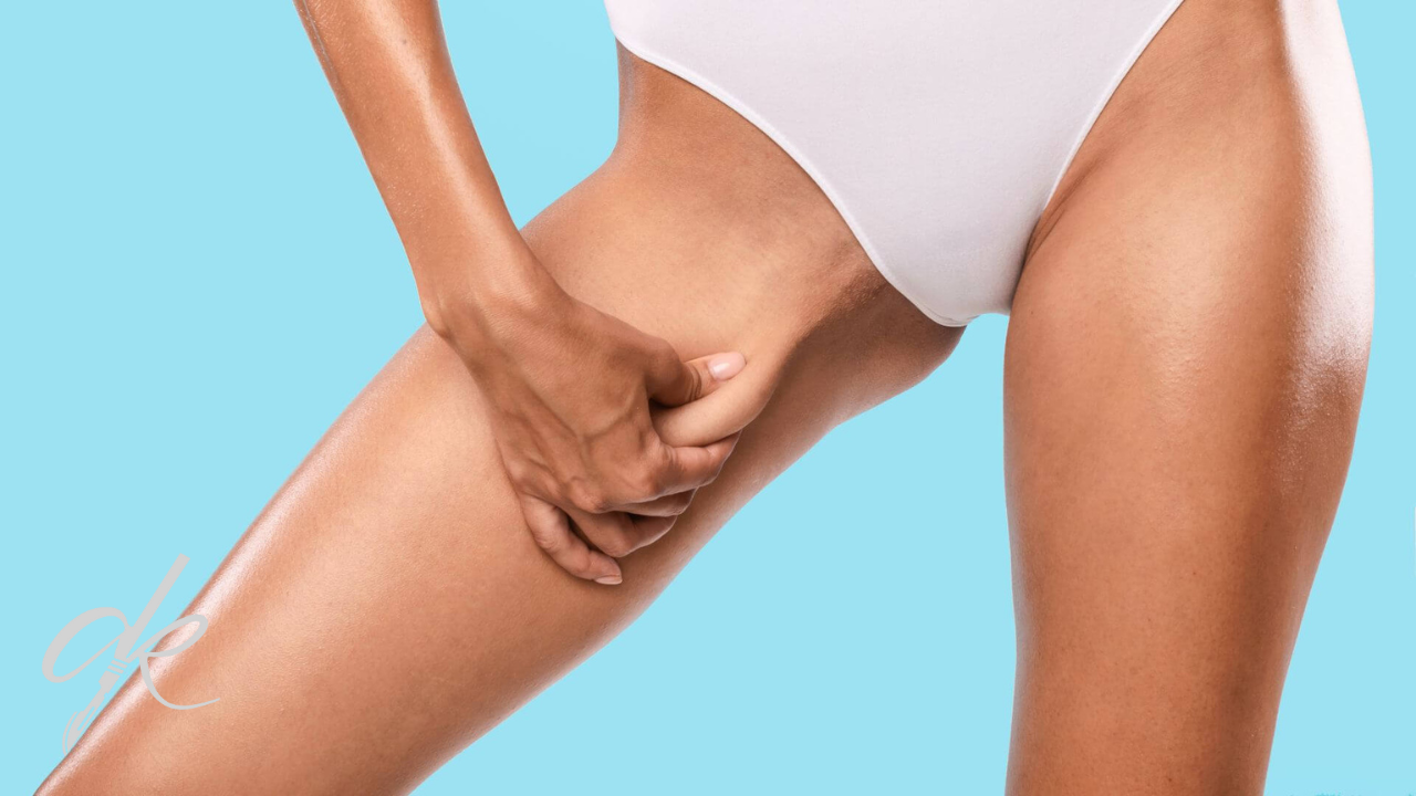 Intervento di Lifting delle Cosce con J Plasma