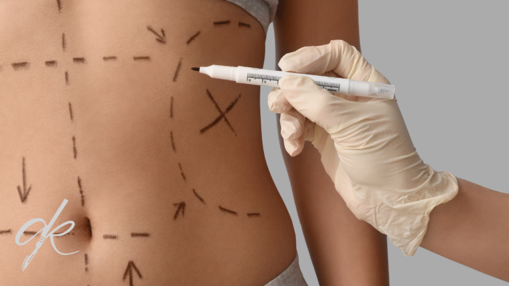 Quanto dura il dolore dopo l'addominoplastica?