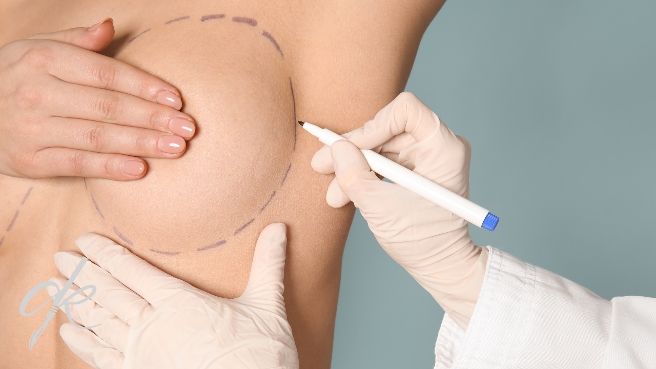 Come dovrebbe essere la cura dopo l'intervento di mastoplastica additiva?