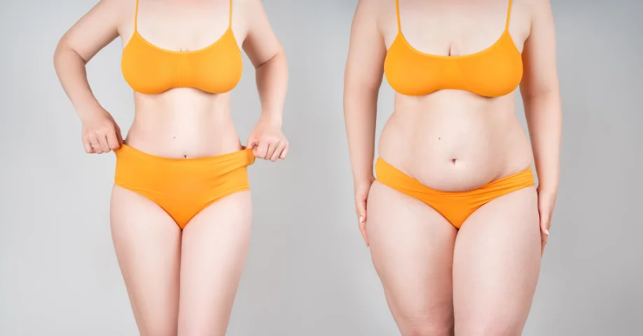 Annelik Estetiği (Mommy Makeover)