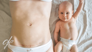 Annelik Estetiği (Mommy Makeover) Fiyatları 2025
