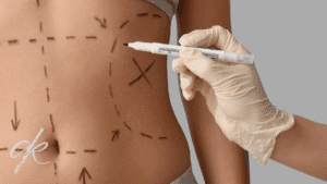 Abdominoplasti sonrası ağrı ne kadar sürer?