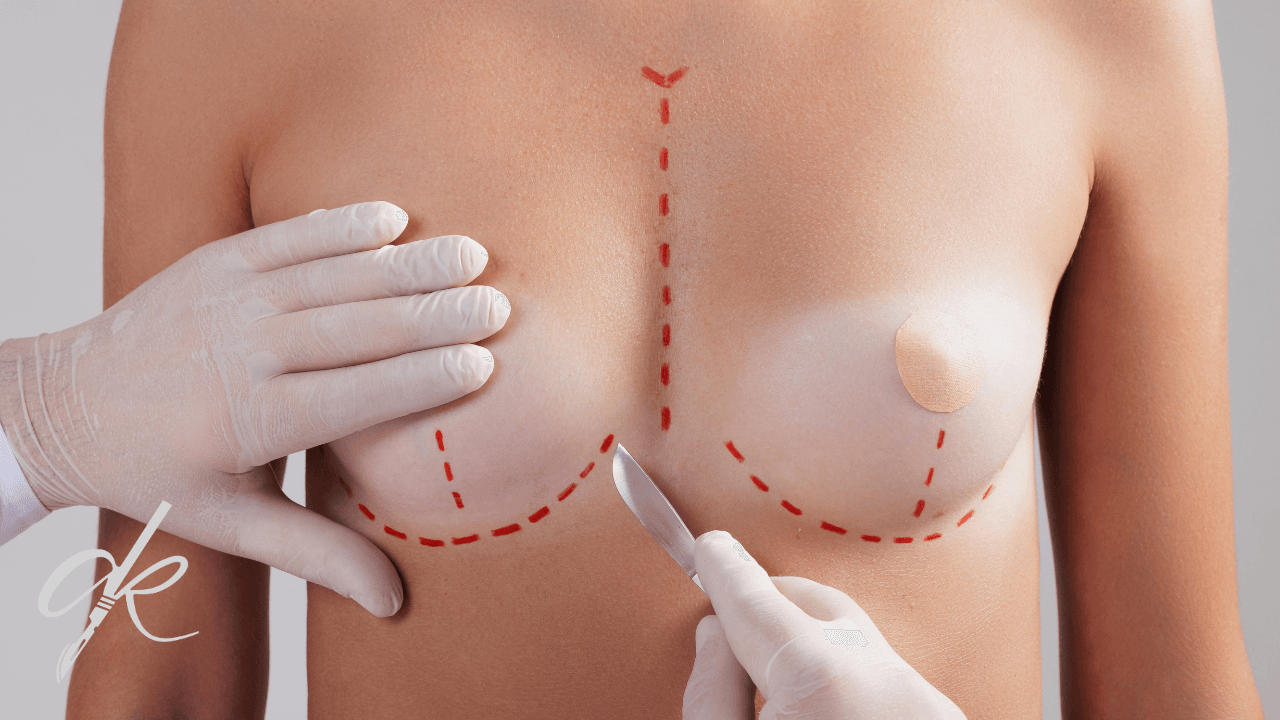 How is Breast Augmentation Surgery Performed?
