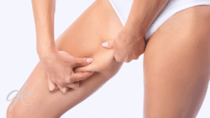 Things You Didn't Know About Thigh Lift Surgery