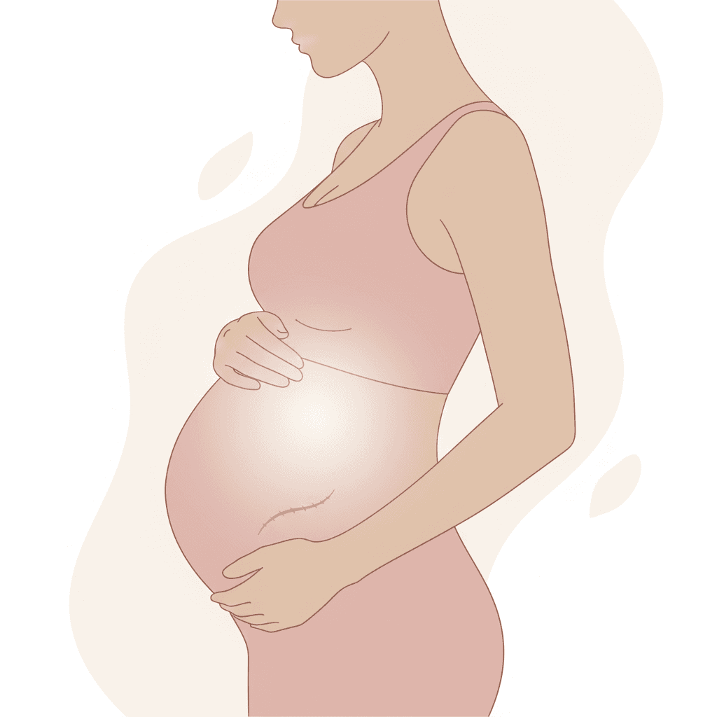 getting pregnant after a tummy tuck