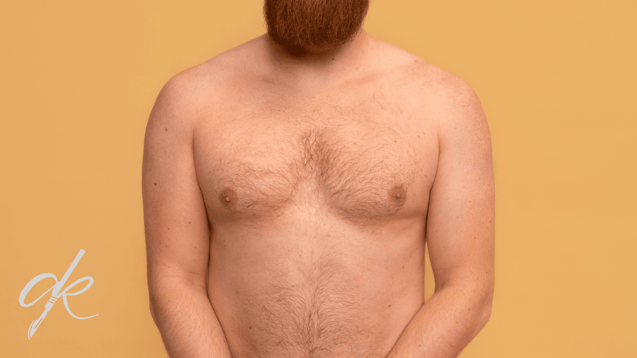 Gynecomastia